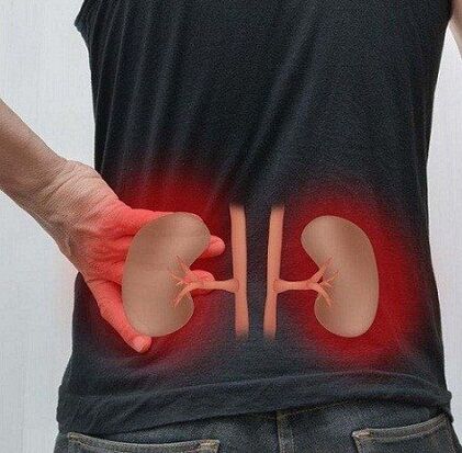 Lows pain can occur in pyelonephritis