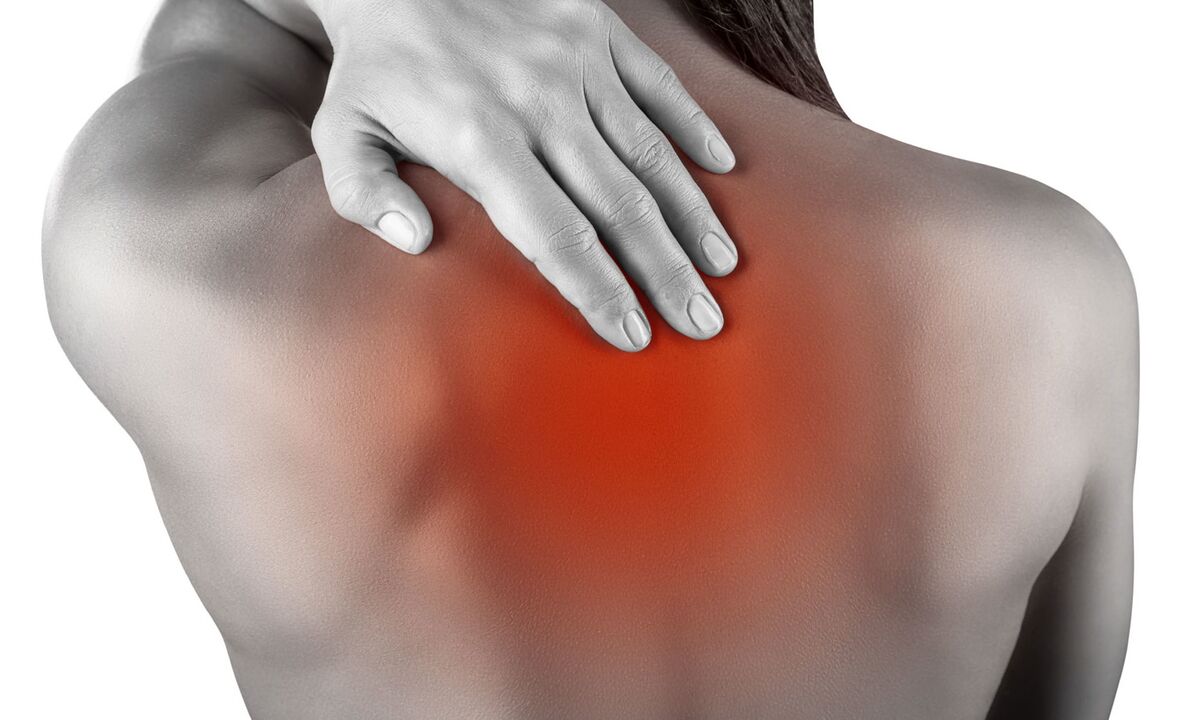 Back pain due to thoracic osteochondrosis