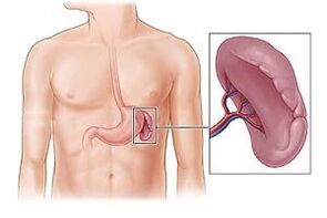 Pathology of the spleen as a cause of pain under the left shoulder blade