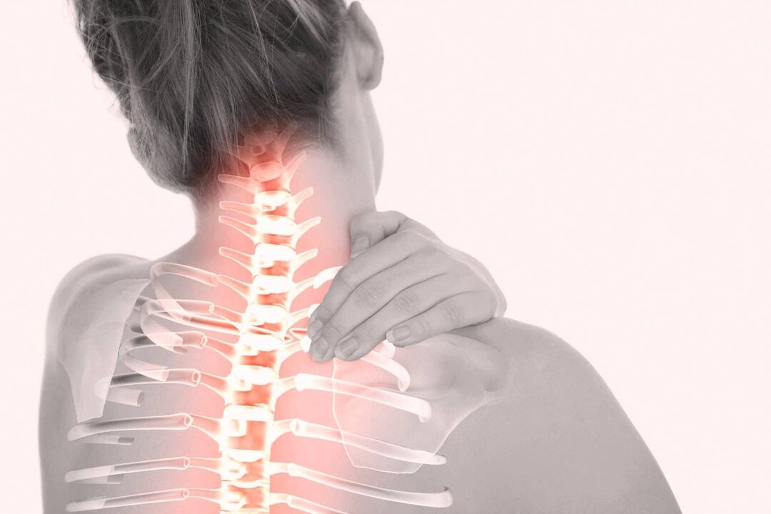 Pain in the cervical spine due to osteochondrosis