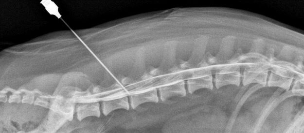 Blockage of the spine with osteochondrosis